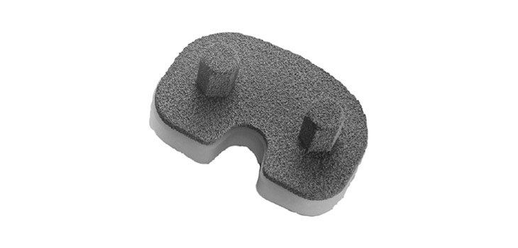 10-Year Follow Up Data for Tantalum in TKA