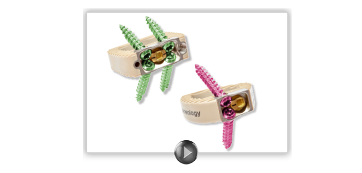 Spineology’s ALIF Receives “Stand-Alone” FDA Clearance