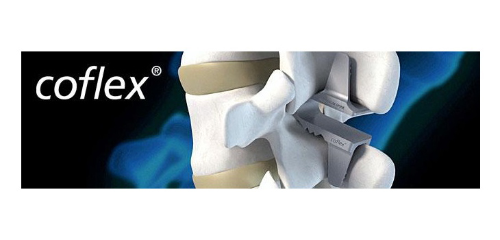 Paradigm Spine: coflex Coverage Policy News