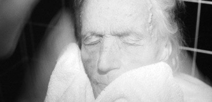 New Data: Elderly Hip Patients, Anesthesia and Complications