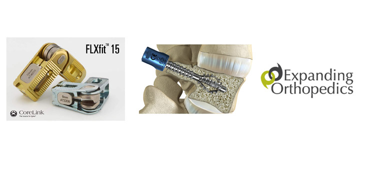 CoreLink Acquires Israeli Spinal Implant Design Firm