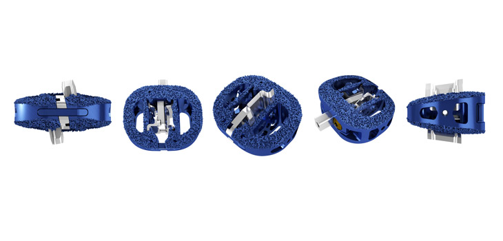 FDA Clearance for Camber Spine’s ALIF System