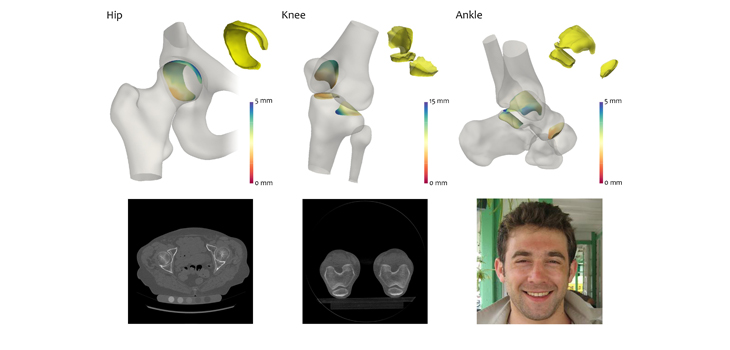 New Algorithm Creates 3D Map From CT Data