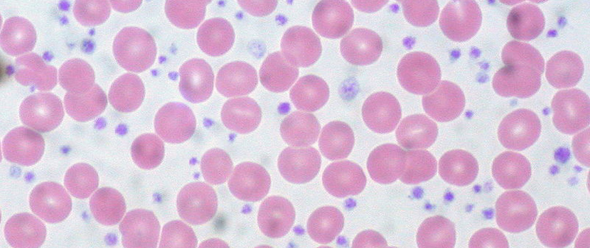Eliminate Complete Blood Count in Primary THA?