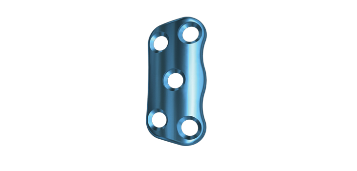 K2M’s 3D Printed Plate System Wins FDA Clearance