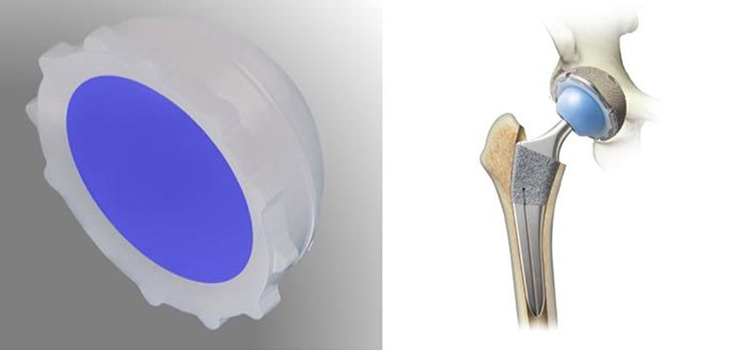 Kyocera’s Aquala Hip Wins Japan’s Top Tech Award