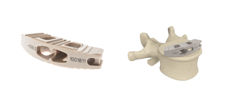 FDA Clearance for Acron Medical’s TLIF System