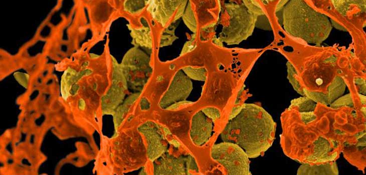 Attacking MRSA With a New Immunotherapy Model