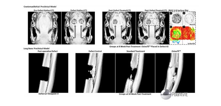OsteoTE Shows Promise for Bone Regeneration