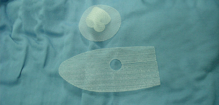 Marlex Mesh Viable for Extensor Mechanism Reconstruction?