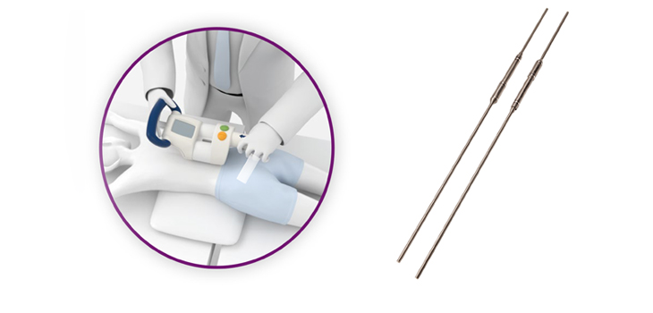 Taking the Measure of Magnetic Growing Rod Complications