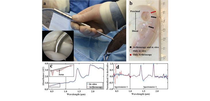 Near Infrared Light Spectroscopy Elevates Knee Diagnostics
