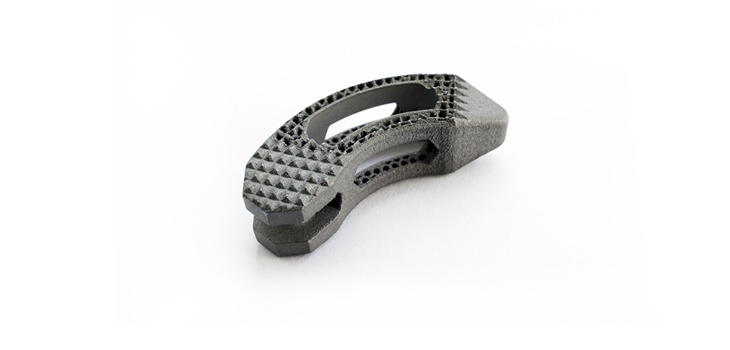 Two Clearances for SpineVision’s HEXANIUM TLIF Cage
