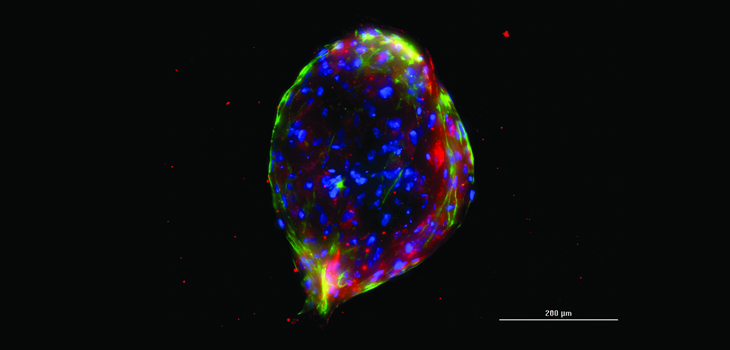 Novel Cellular Approach Forms Functional Chondrocytes