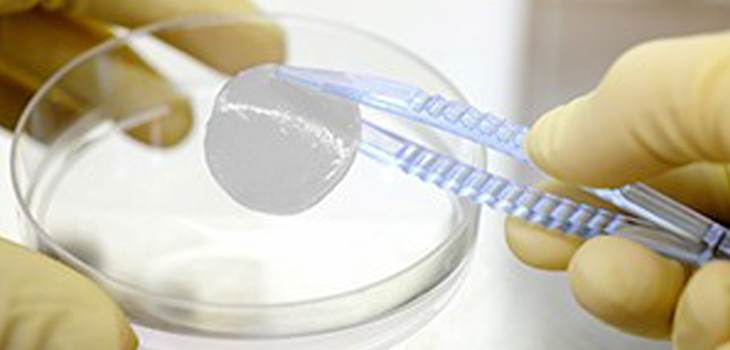 Strong Data From Disappointing NeoCart Trial