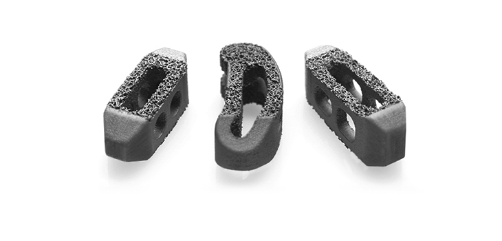 3D Printed Cage With “Unique Lattice Structure” Cleared