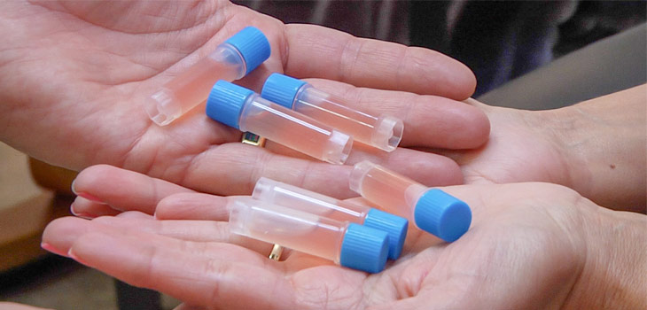 The Wild West of “Stem Cells”: Updated