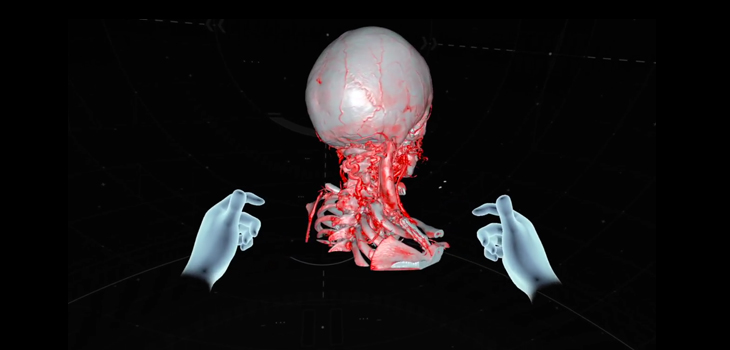 Virtual Reality Spine Surgery Tool Launched