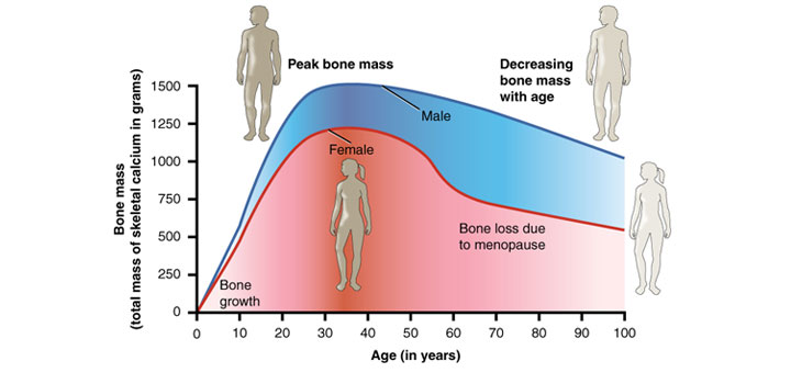 New Data Confirms: Americans’ Bone Health Is Declining