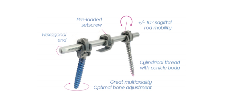 SpineVision: CE Mark for Next-Gen P.L.U.S. Spinal System