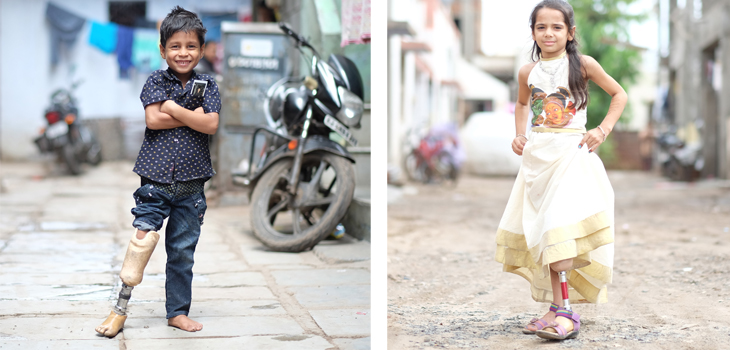 Charity, A Leg To Stand On, Partners With J&J