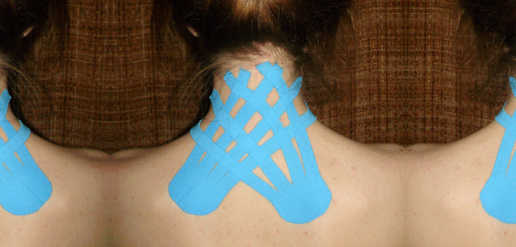 Stretchable Tape Retrains Muscles