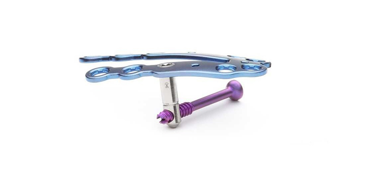 No Plantar Gapping With Omni Plating System