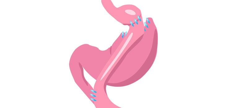 Study: Orthopedists, Bariatric Surgeons Should Collaborate