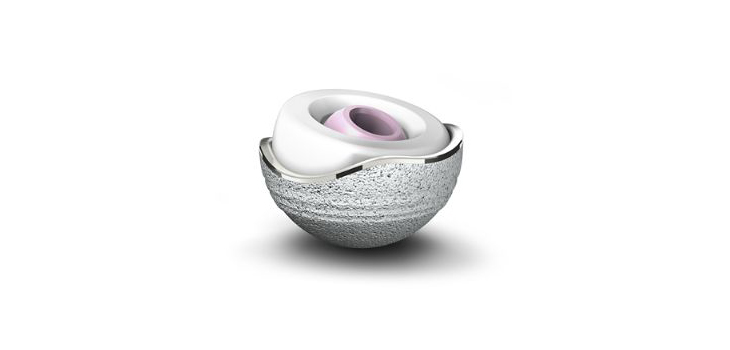 Study: Dual Mobility Hip Implant Reduces Risk of Dislocation