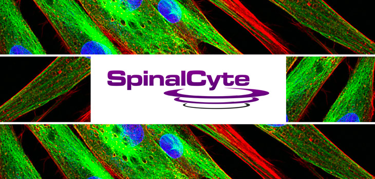 New Study Data for CybroCell Back Pain Injection