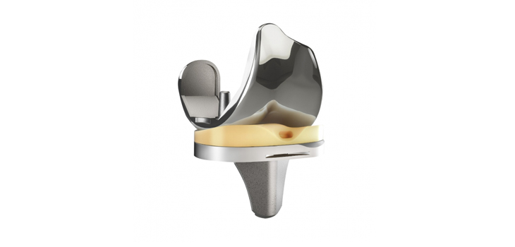 DJO’s “Dual-Pivot” Knee: Positive Clinical Data