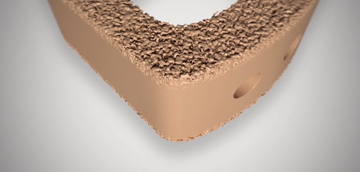 FDA Clears NuVasive Use of Porous PEEK
