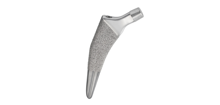 United Orthopedic Hip Stem, Acetabular Extension Available in U.S.