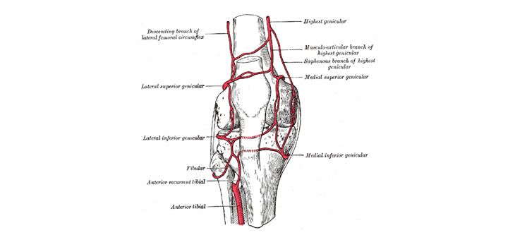 Study Pegs Rate of Geniculate Artery Injury During TKA