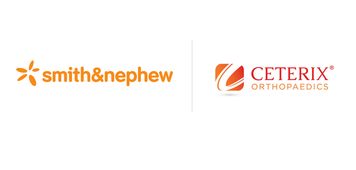 Smith & Nephew Acquires Ceterix for $105 Million