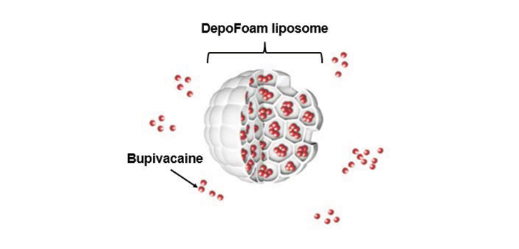 Liposomal Bupivacaine Optimizes TKA Economic Outcomes