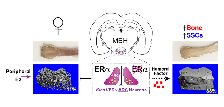 Estrogen Critical to Bone Density – New Research