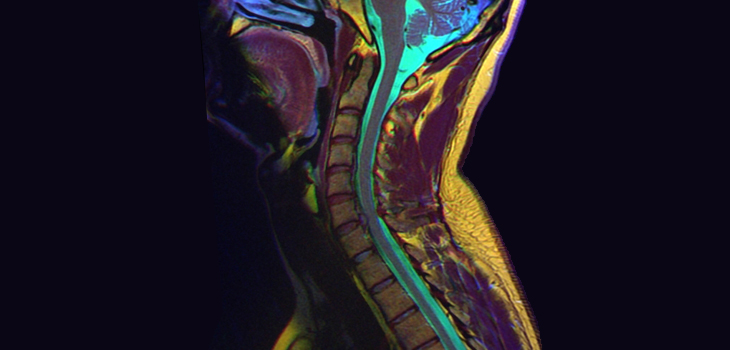 Study: Annular Closure Device Good Option