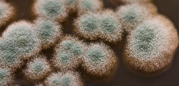 Can UV-C Air Decontamination Cut Periprosthetic Joint Infection?