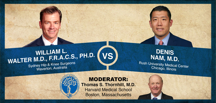 Walter v. Nam: Medial Pivot Designs Avoid the Need for Ligament Balancing