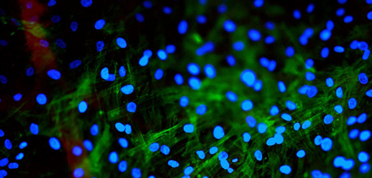 Smith & Nephew Jumps Into Stem Cells