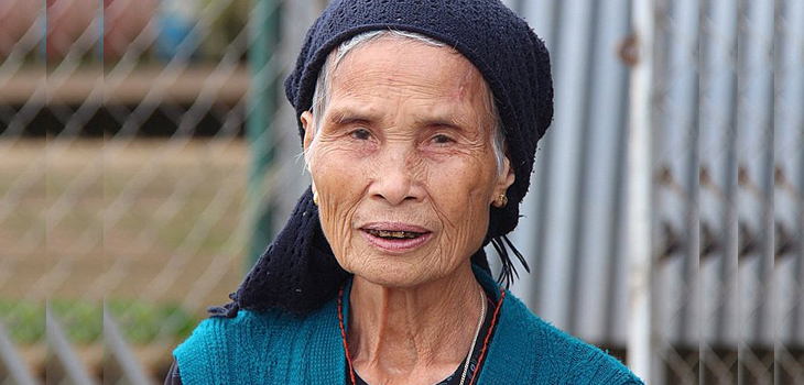 Does Bundled Care Discriminate Against Older Frail Patients?