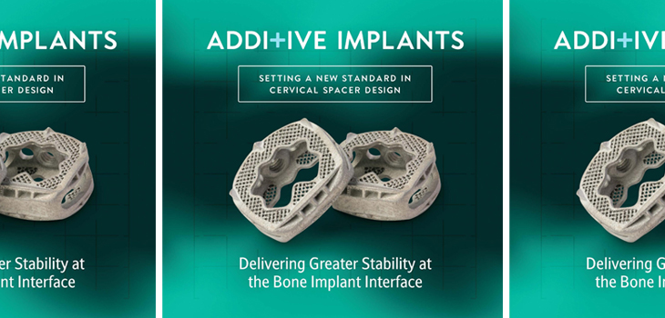 FDA Clears Additive Implants’ Cervical Spacer