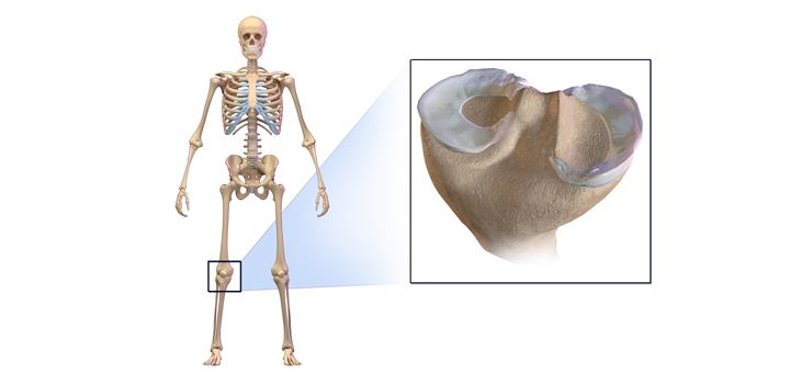 Cartilage & Meniscal Rehab Consensus Protocols Announced