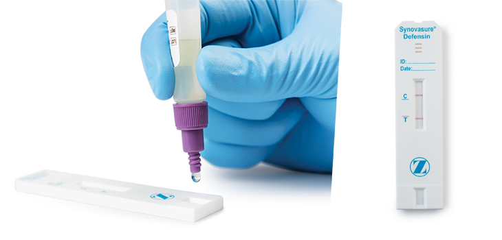 Joint Replacement Infection Diagnostic Kit Approved by FDA