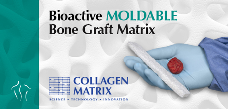 FDA Clears OssiMend® Bioactive Moldable Bone Graft Matrix
