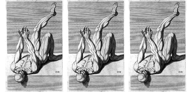 Thigh Circumference Affects Direct Anterior Hip Outcomes?