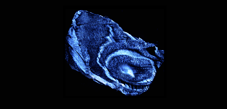 Nutrients Define Spine Disc Health: New Data