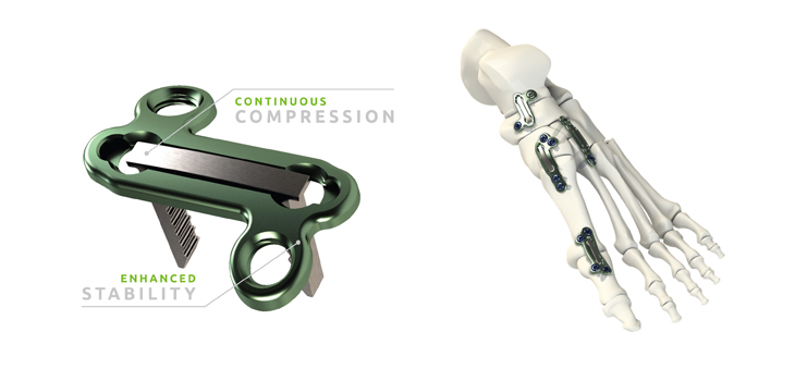 HealthpointCapital Acquires CrossRoads Extremity Systems