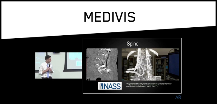 Medivis Holographic Visualization Technology Cleared by FDA